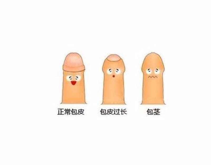 男科检查是否需要脱裤子?这个问题的答案其实没有那么绝对。